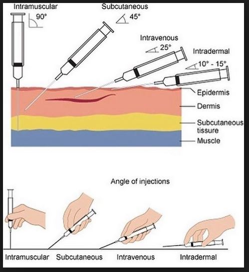 INJECTIONS.JPG