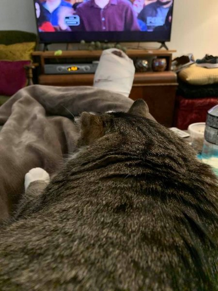 June 17 foot surgery 2020.jpg