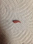 toenail.jpg