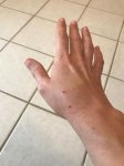 cat bit wound 2.jpg