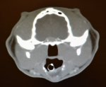 tumour2.jpg
