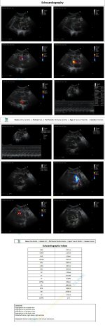 ECG Chiu_20Dec2025.jpg