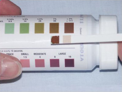 urine.jpg